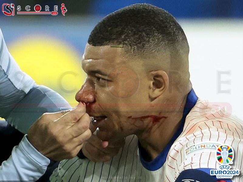 Insiden Patah Hidung Kylian Mbappe di Euro 2024