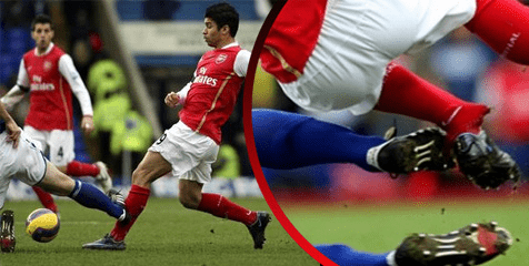 Cedera Paling Mengerikan Di Sepak Bola: Kisah dan Dampaknya Cedera Paling Mengerikan Di Sepak Bola